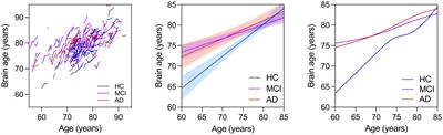 Longitudinal accelerated brain age in mild cognitive impairment and Alzheimer’s disease